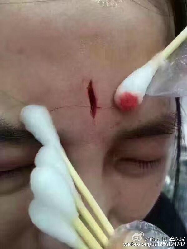 南京鼓楼警方通报,受伤护士为轻微伤,已得到及时治疗.
