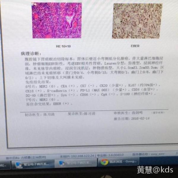 胃癌全胃切除后的切片报告大家帮忙看看接下来怎么办好