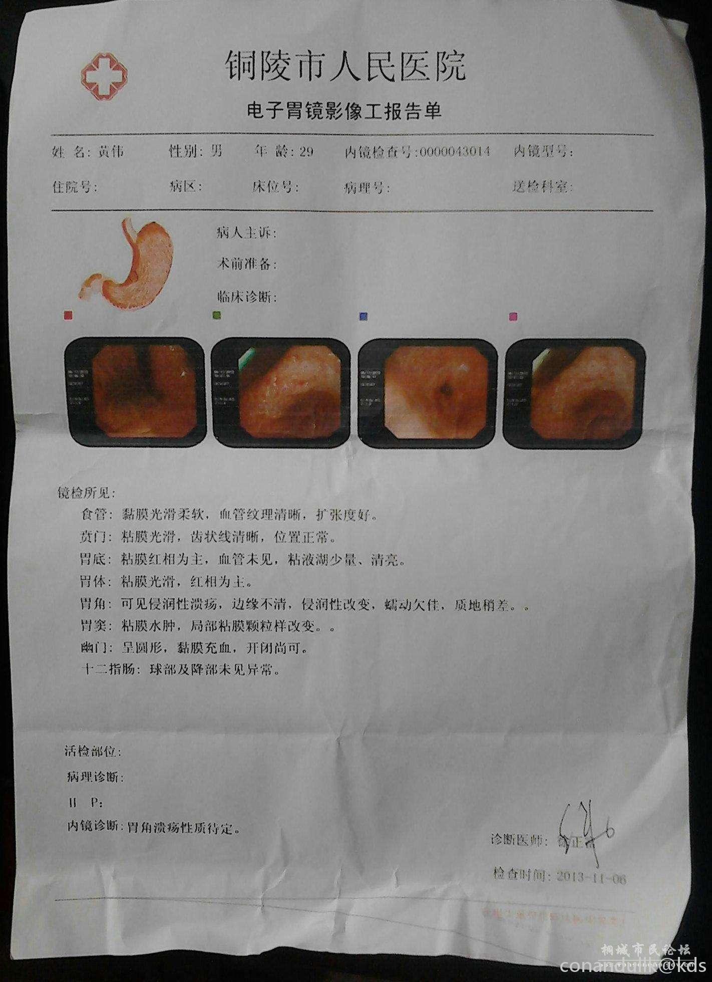 这个报告是p的?没做过胃镜的还瞎逼逼