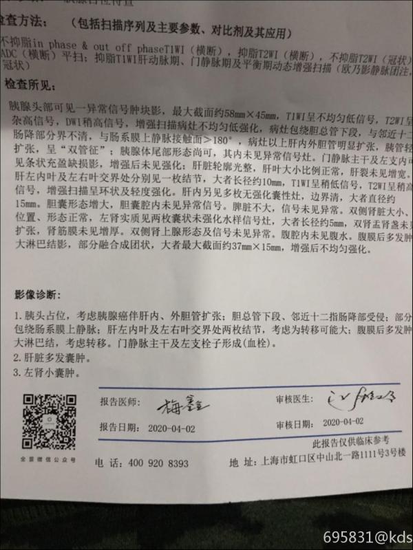 爸爸被怀疑得胰腺癌