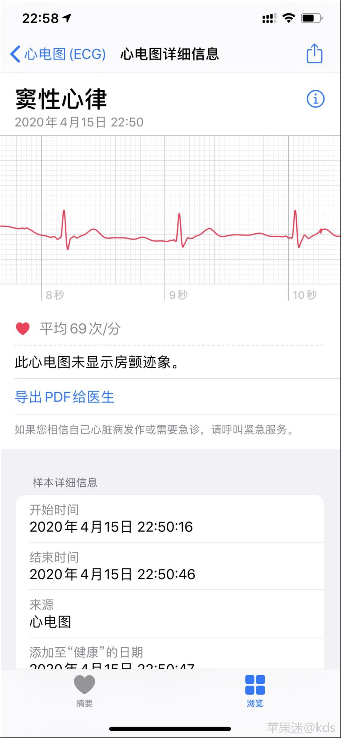 apple watch国行,心电图功能终于开通了