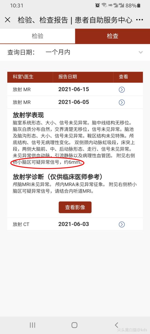 【求助】颅脑mr显示可疑信号,但不知道是什么