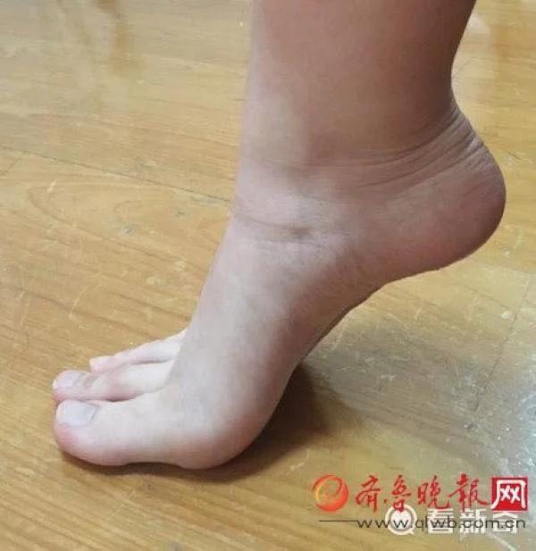 女生脚趾修长如手指走红