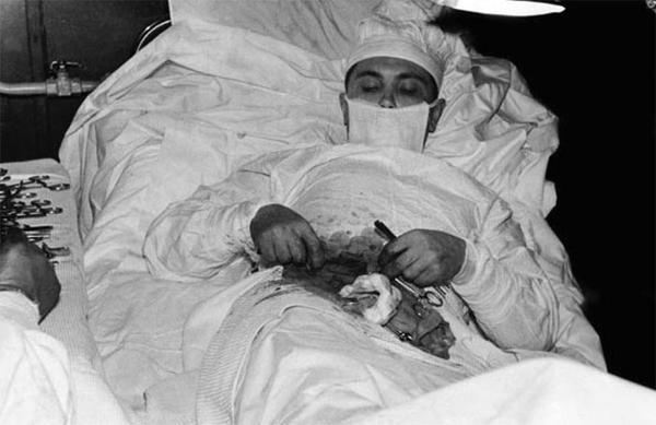 1961年,剧痛下给自己做阑尾切除手术的苏联医生列昂尼德·罗格佐夫.