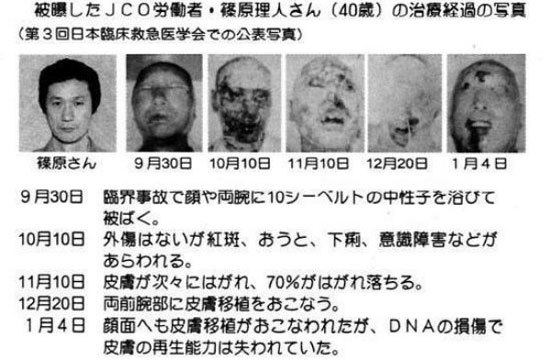 世界上最痛苦的死亡---日本东海村核临界事故