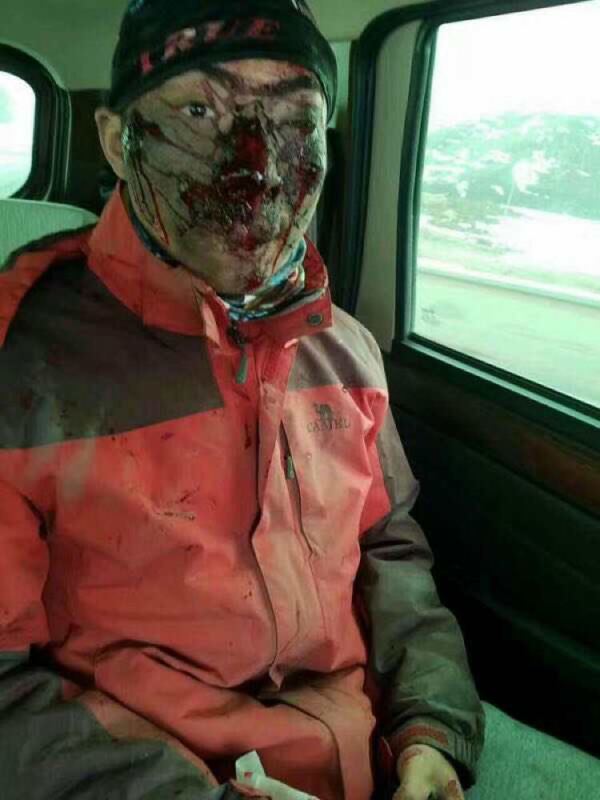 鳌太其中一名死者