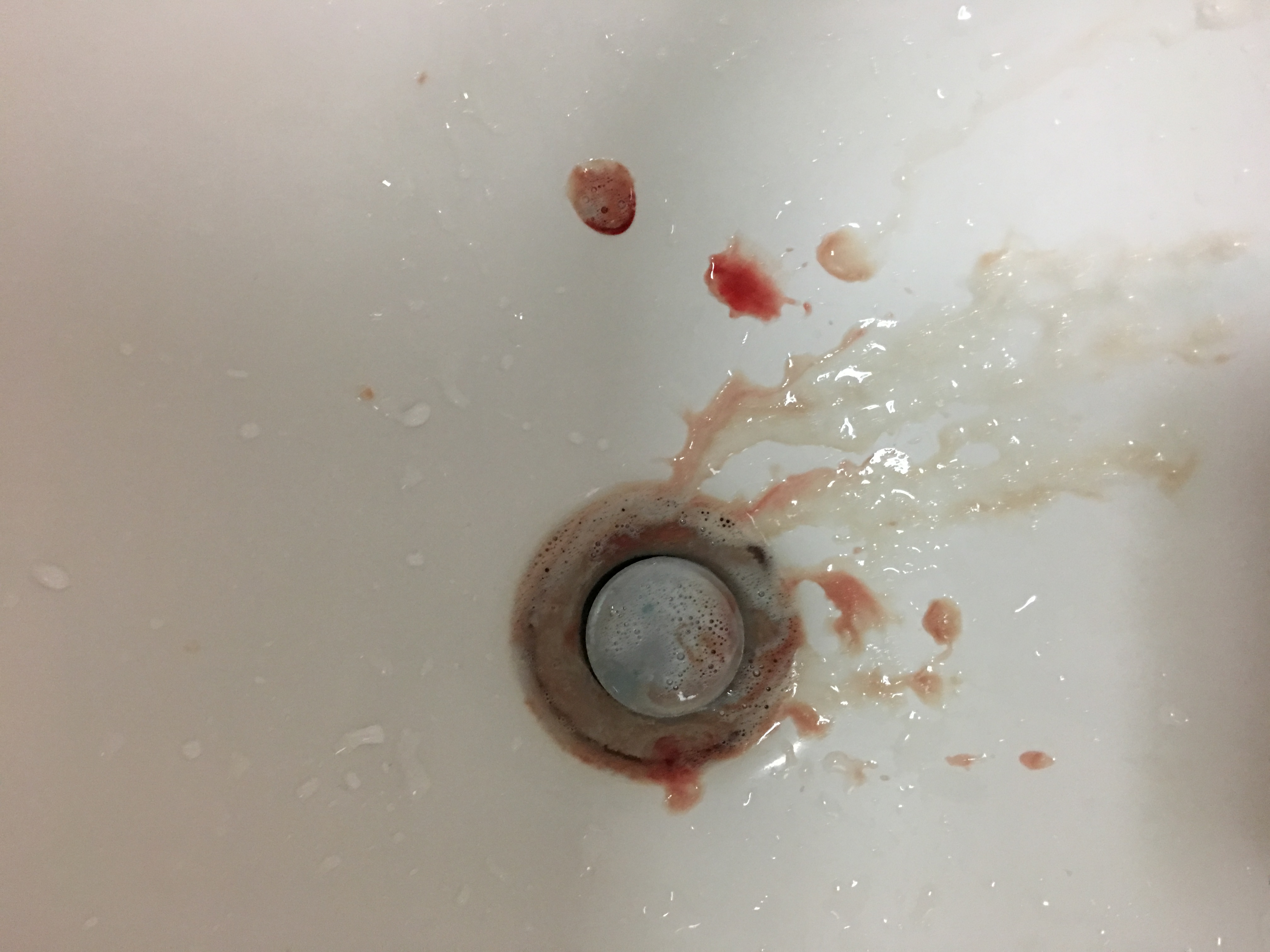 牙龈出血的照片图片