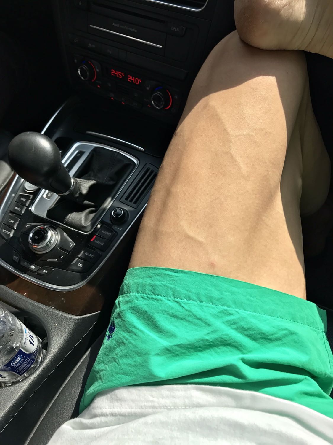 健身房出来发现大腿上一条条筋爆出!