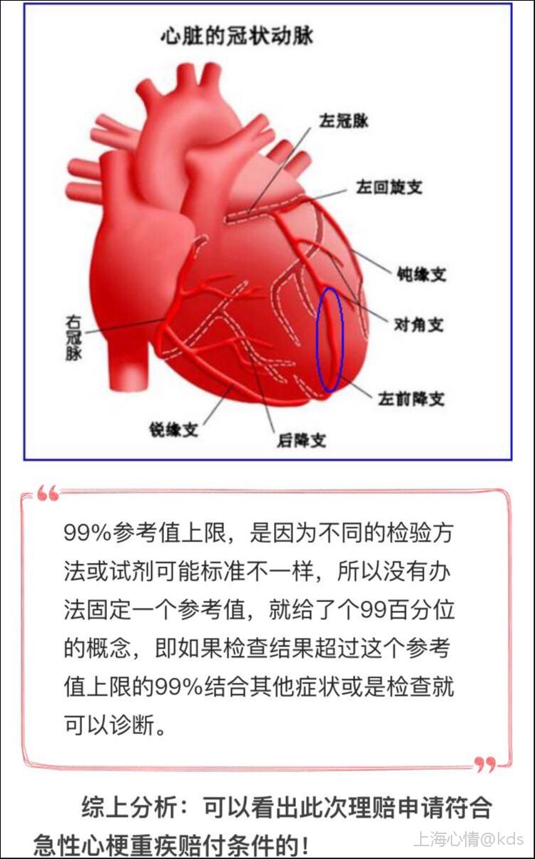 前降支第一对角支图片