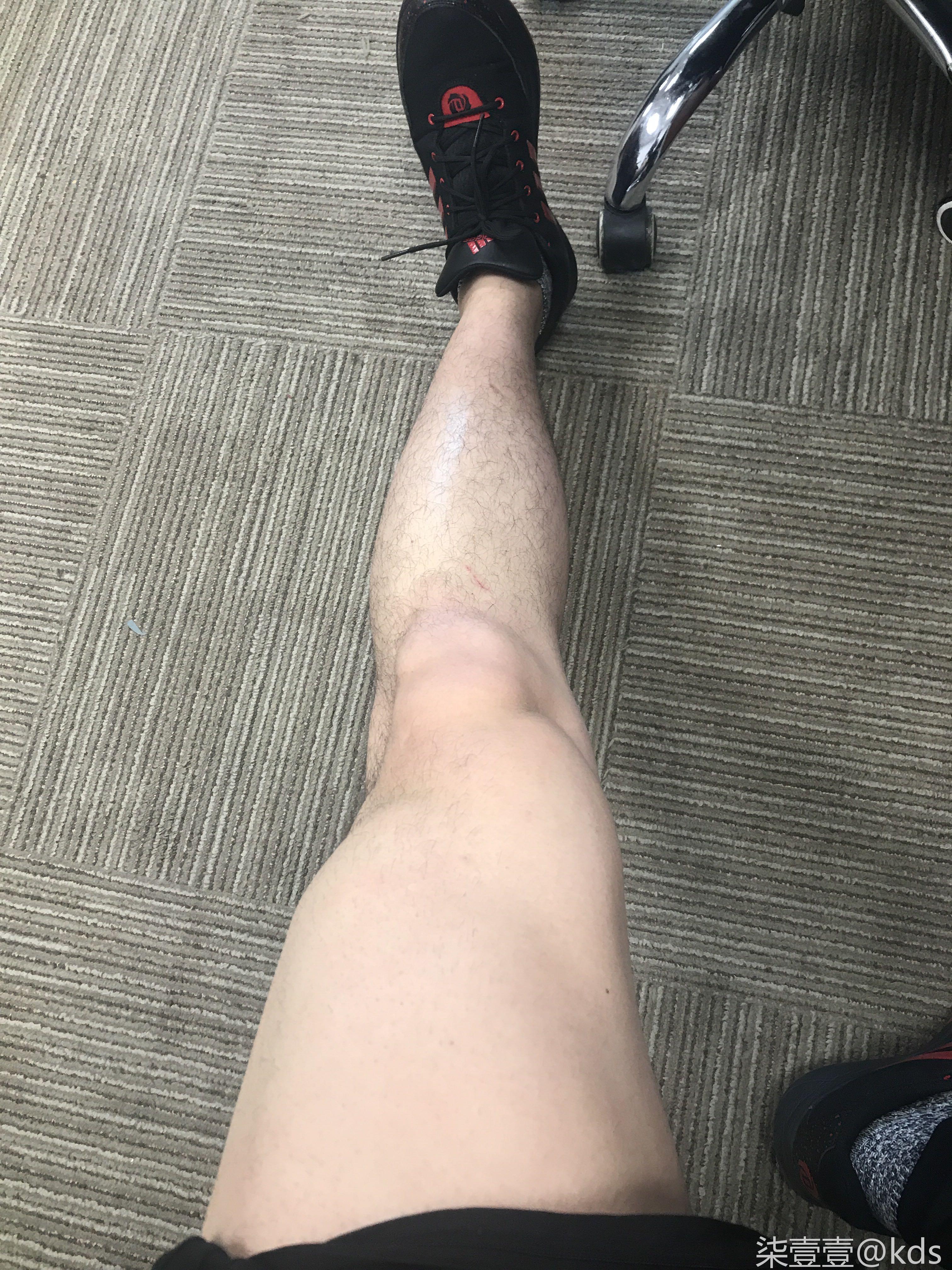 大腿怎么练啊,现在不够粗啊