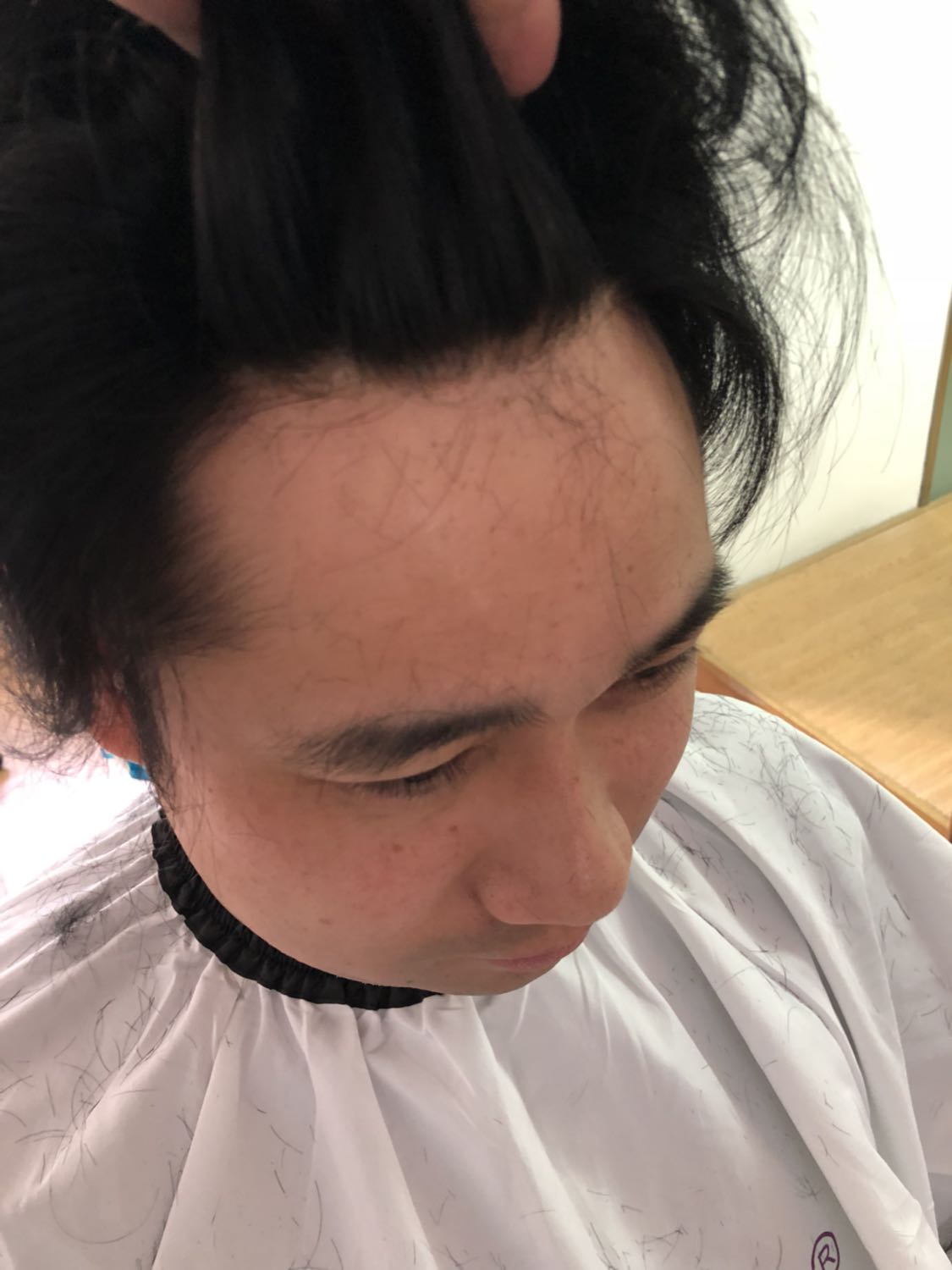 一个脱发310的创业之路,如何解决脱发问题-宽带山kds-宽带山社区-城市