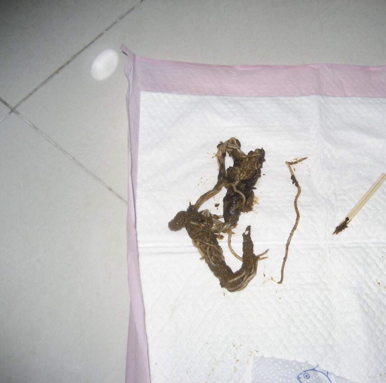 那就是金针菇,昨天晚上吃的金针菇,她强大的胃酸竟然没消化掉,原原