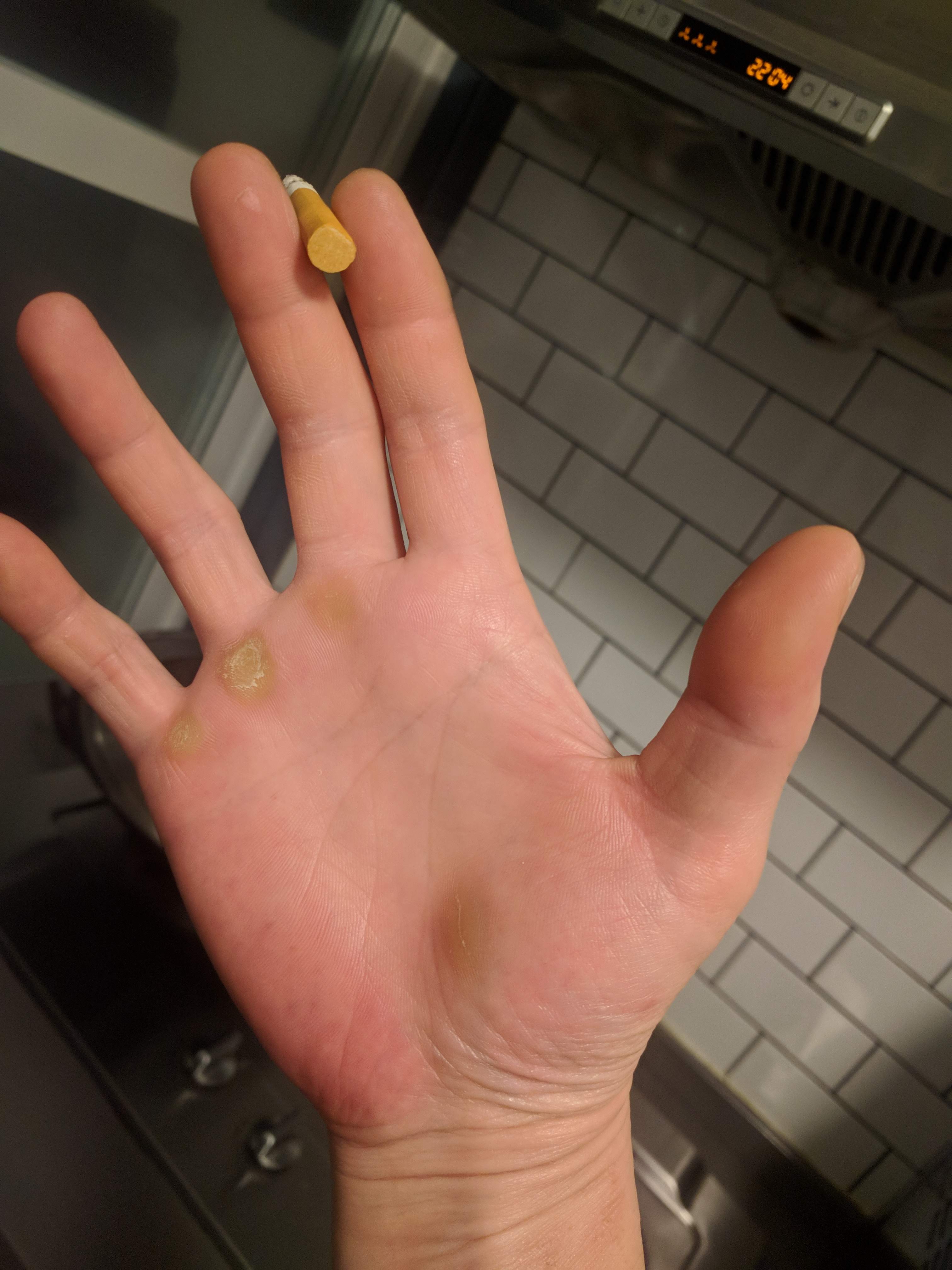 这张照片手掌上的老茧更清楚:)