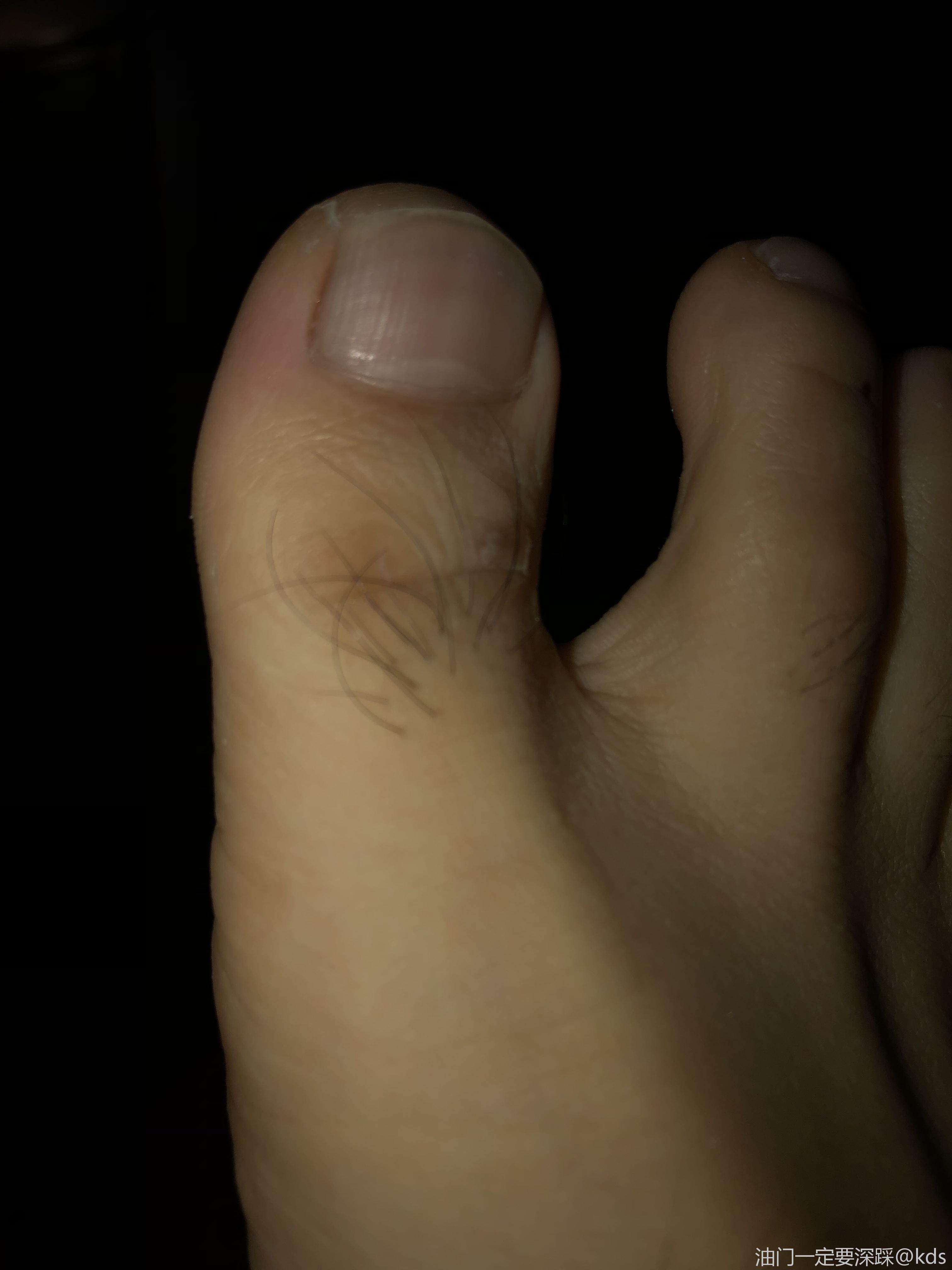 我就不信有人脚趾头上面毛有我长