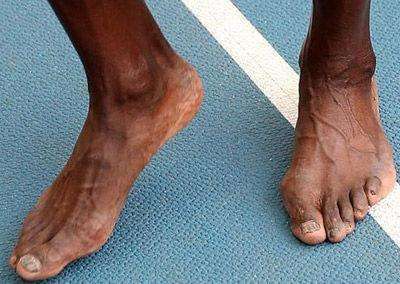 专业篮球运动员的脚