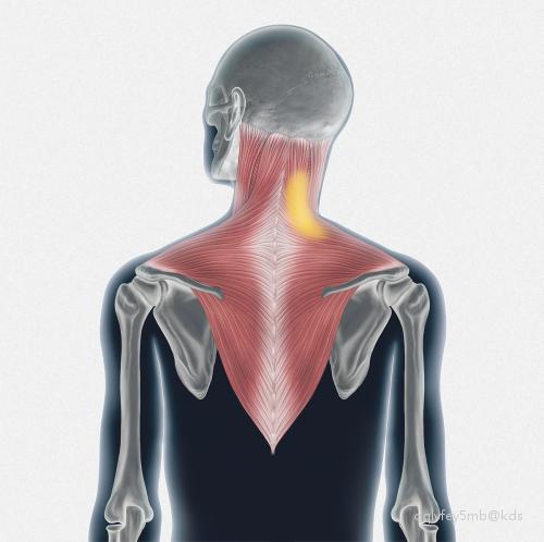 你的痉挛性斜颈好了吗,还在走弯路吗?