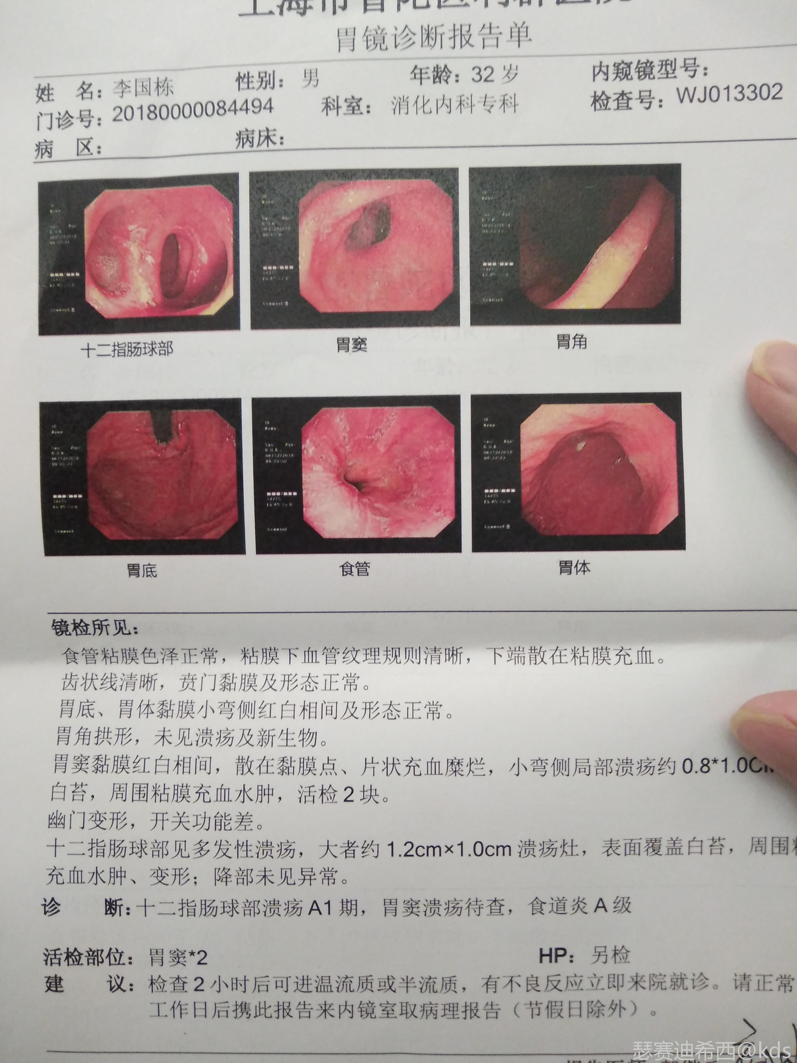 苏州胃镜单子图片图片