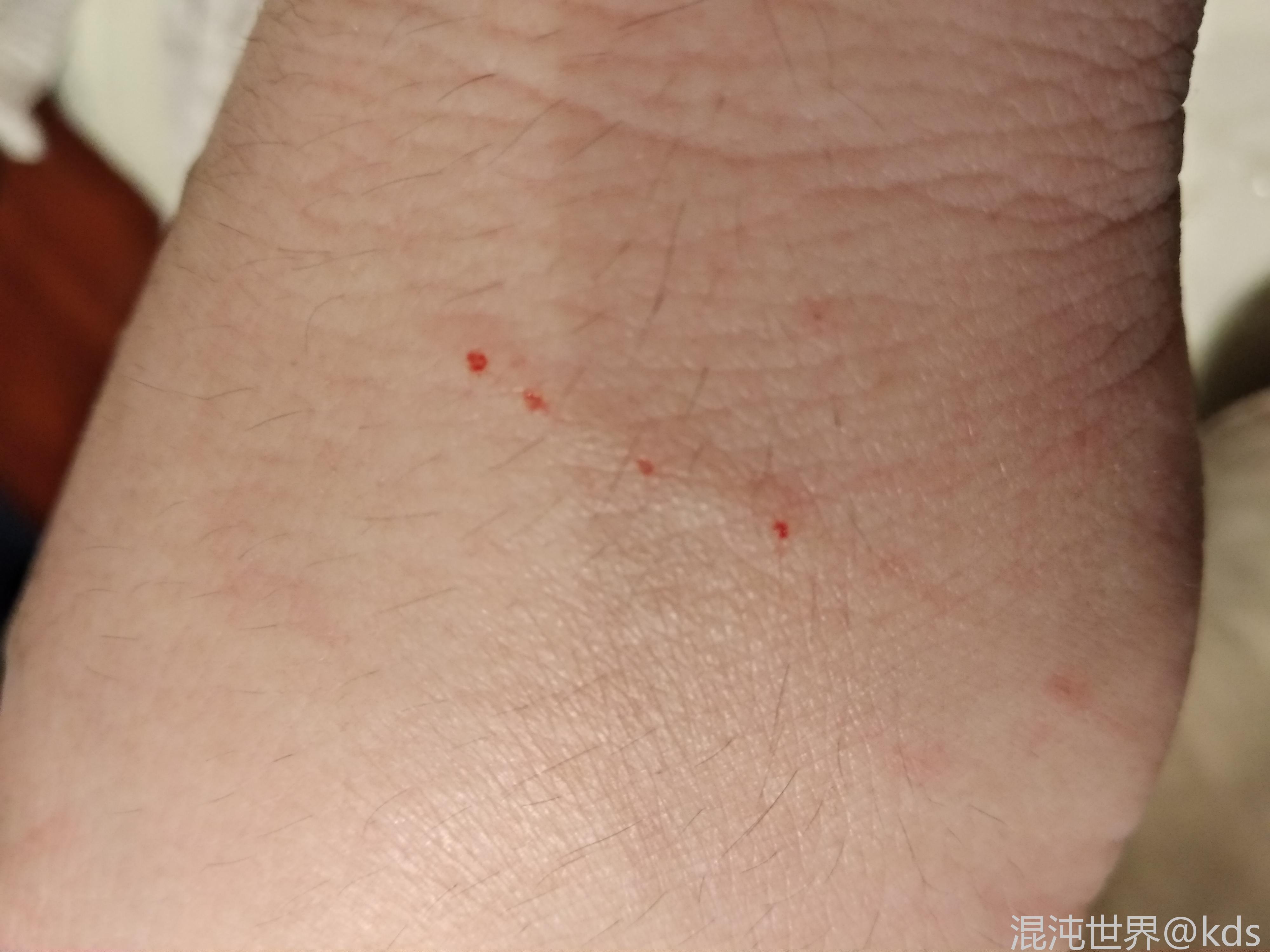 幼犬咬伤的伤口图片图片