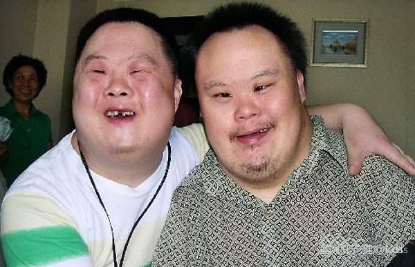 这里有唐氏面容的么