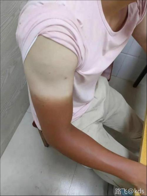 作为一个男人你们怕晒黑哇?