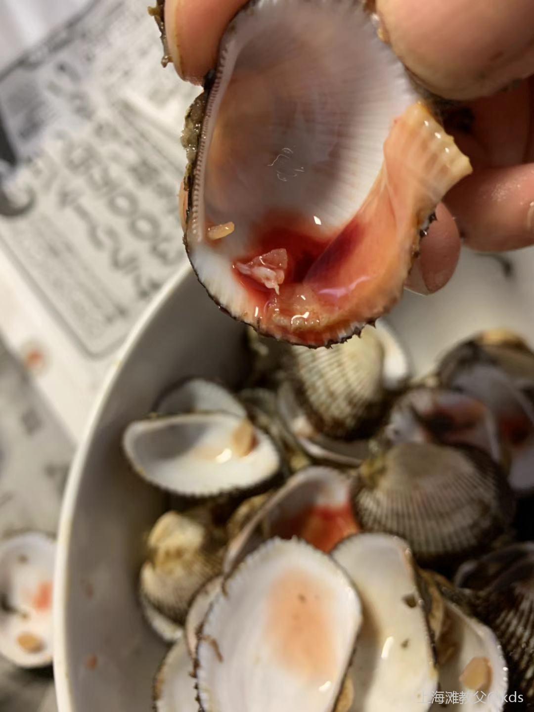 刚刚吃了一盘毛蛤蜊,会得甲肝吗?