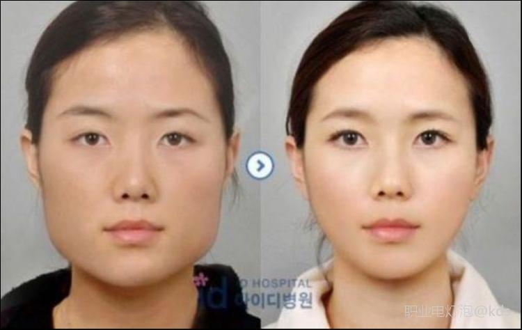 山上有整容脸吗?整容脸摸自己脸会有感觉吗?