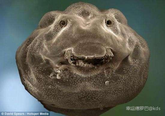 人类的蝌蚪有人放大看过伐?