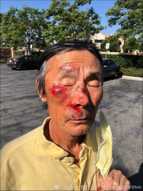 加拿大亚裔被殴打