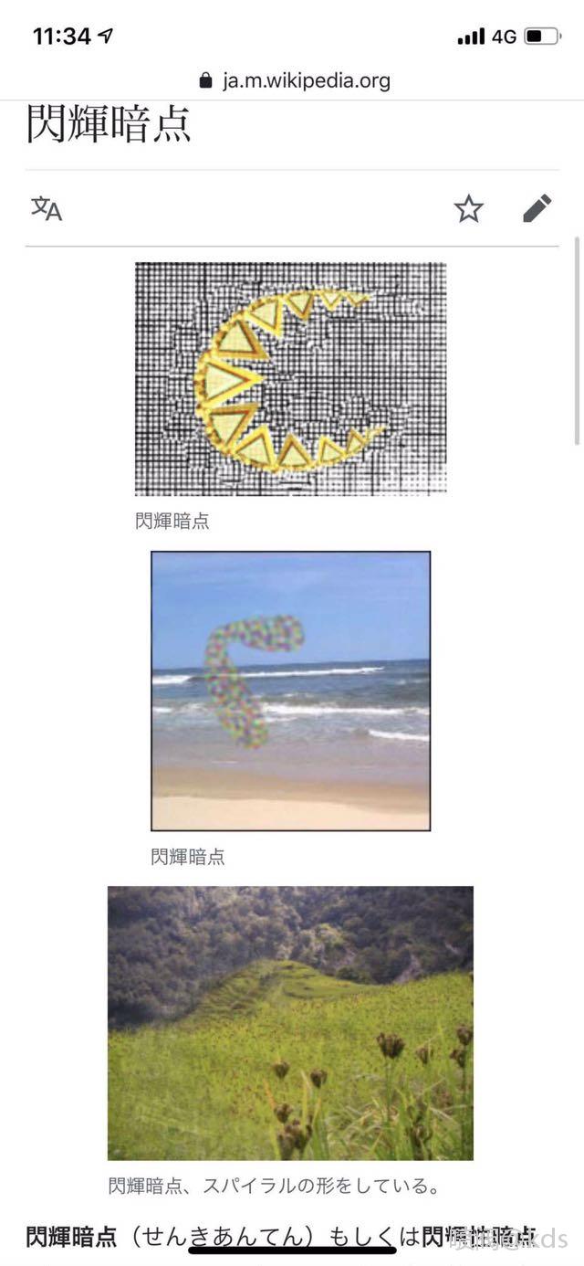 我有一种怪病,闪辉性暗点,眼睛会看不清