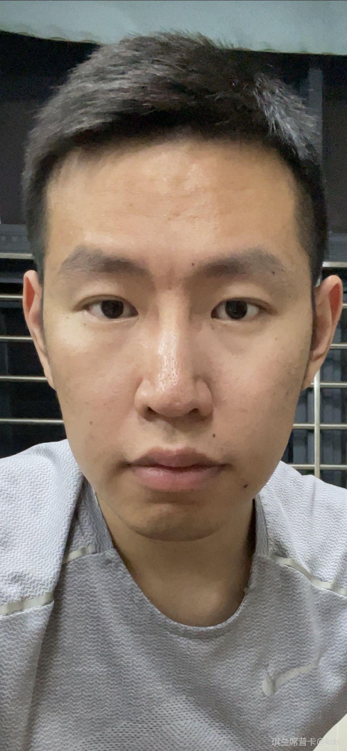 感觉鼻子毁在鼻头上了