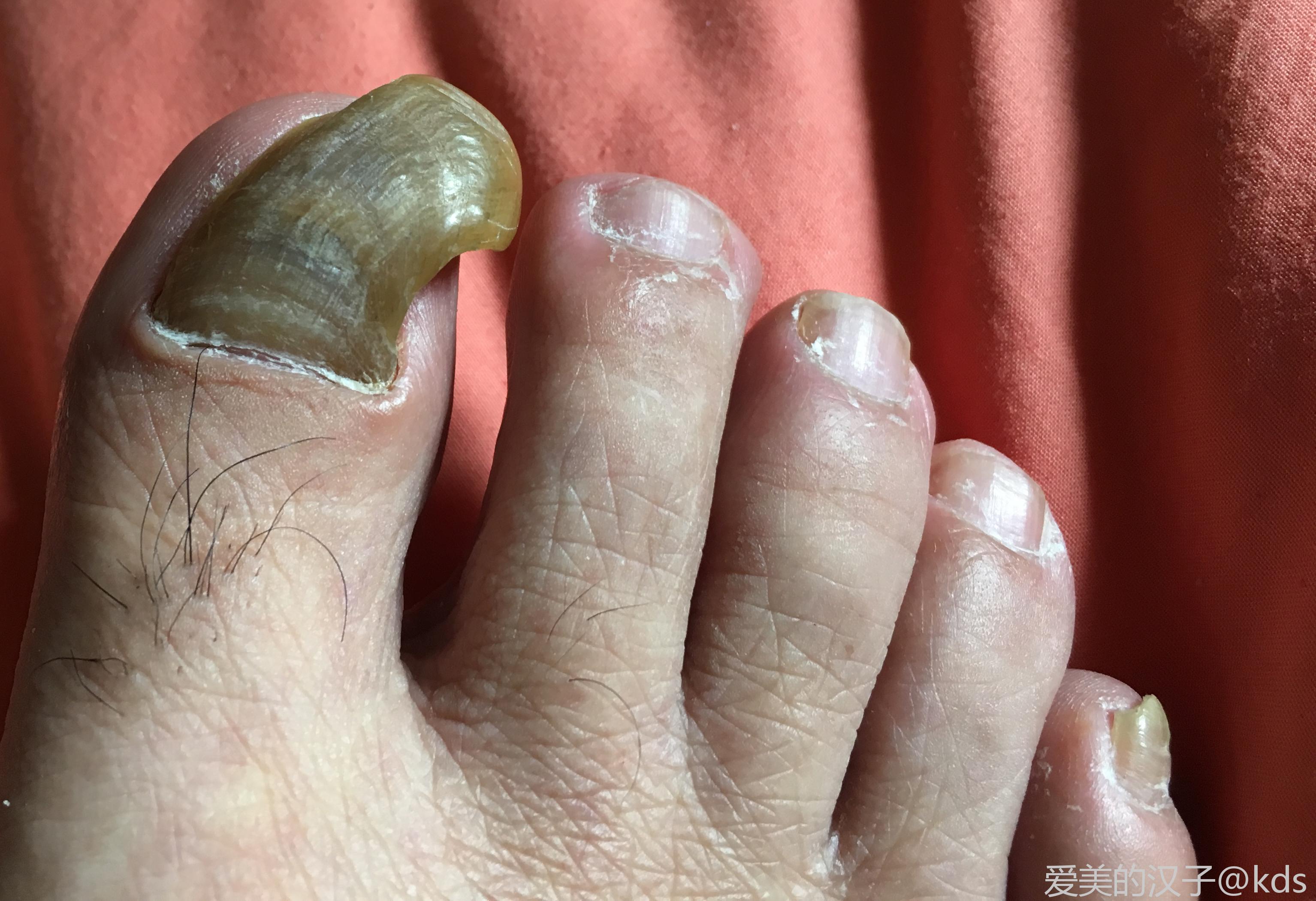 懂的入(图片渗人,慎入)