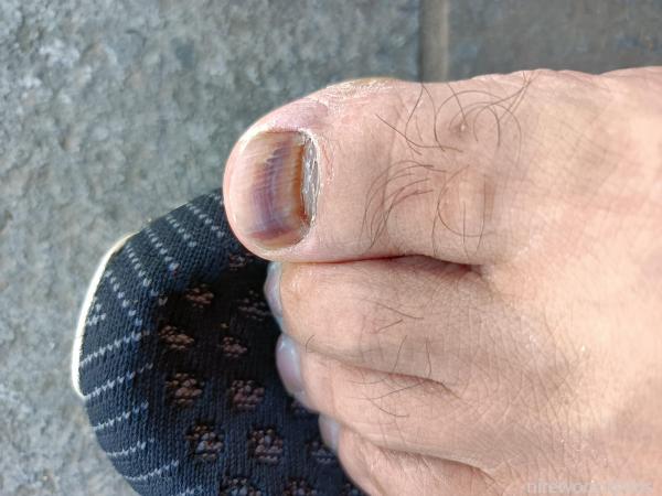 懂的入图片渗人慎入