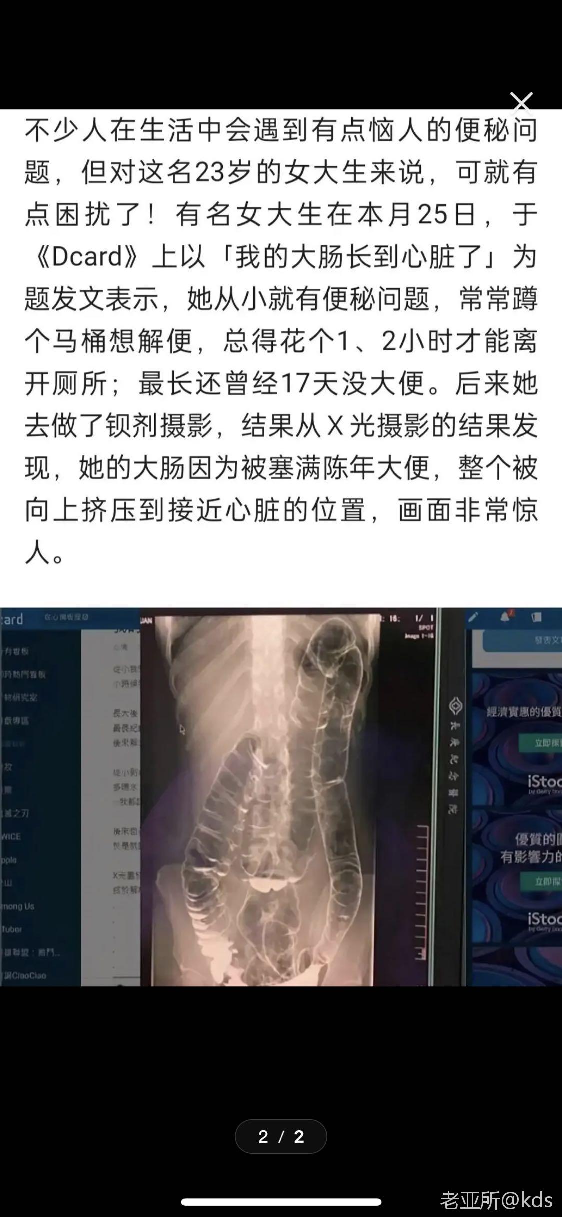 一个美女的x光片